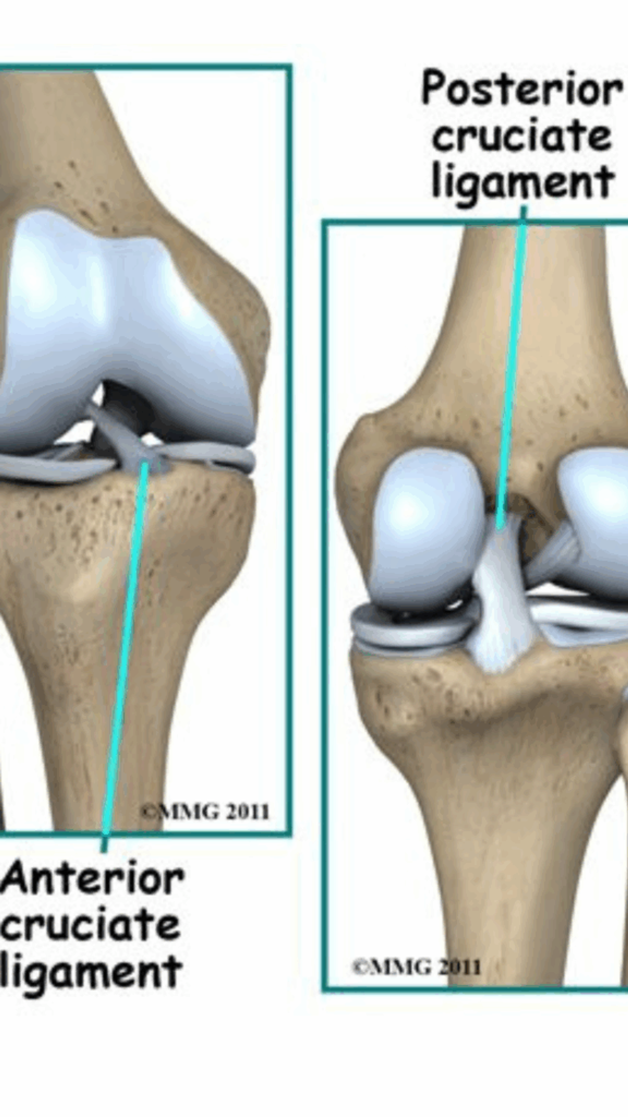Mastering Sports Injury Recovery: Avoiding Common Pitfalls for Successful Return