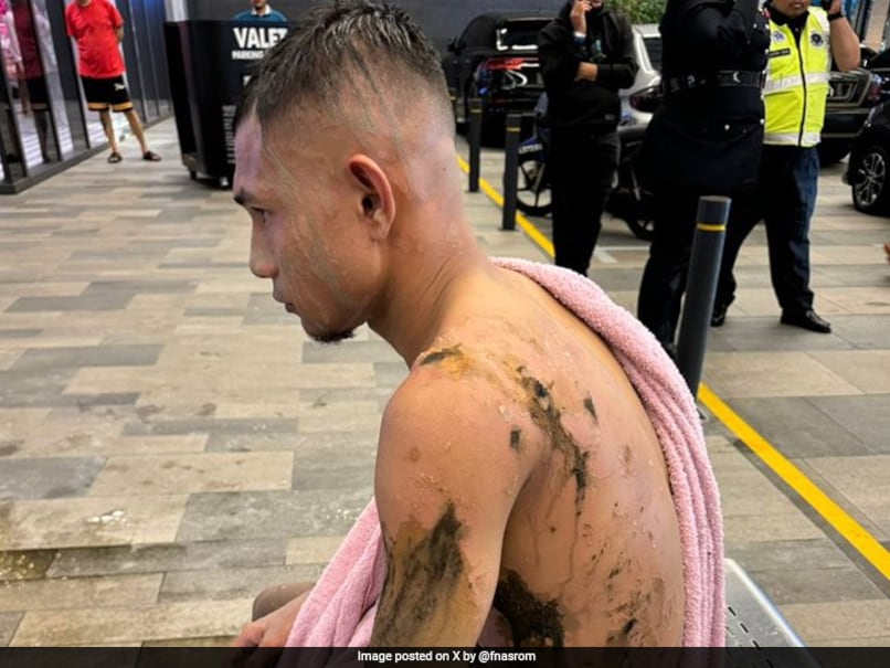 Malaysian Footballer Faisal Halim Suffers Acid Burns in Shopping Mall Attack