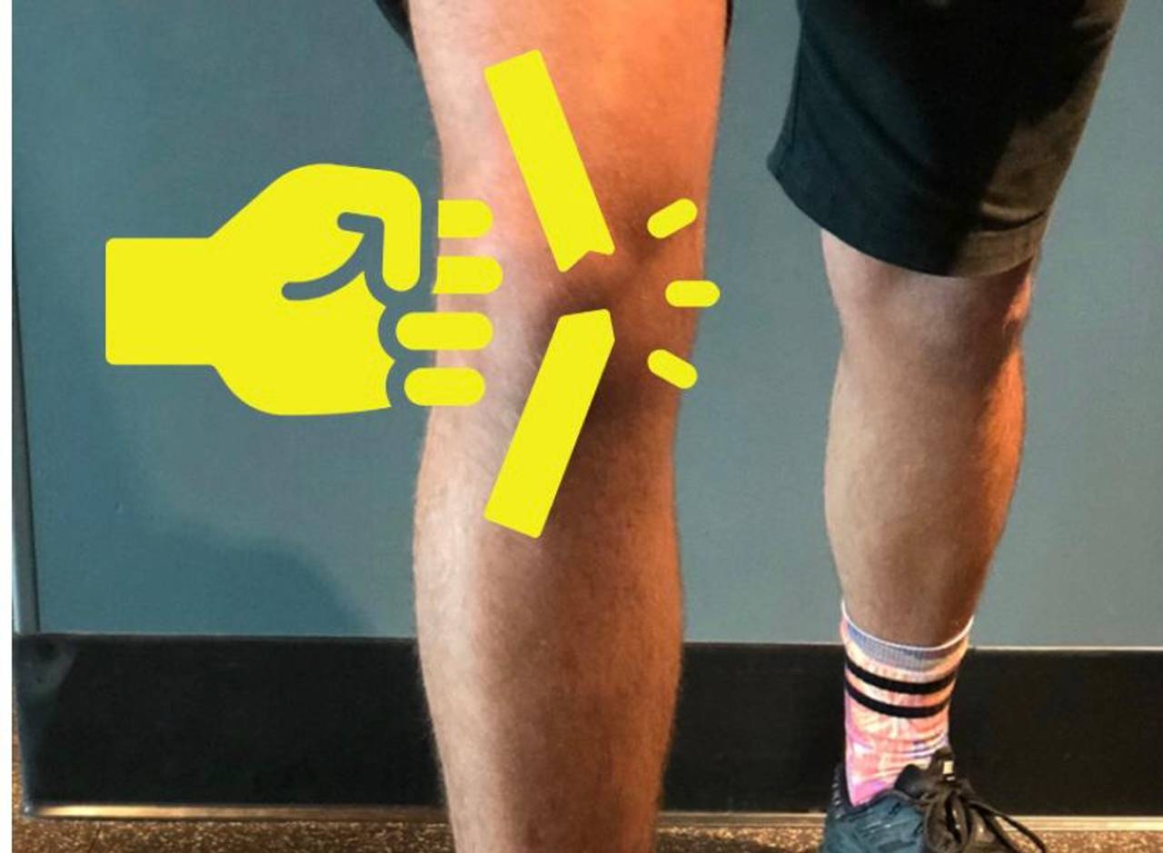 Mastering ACL Recovery: A Comprehensive Guide to Long-Term Success